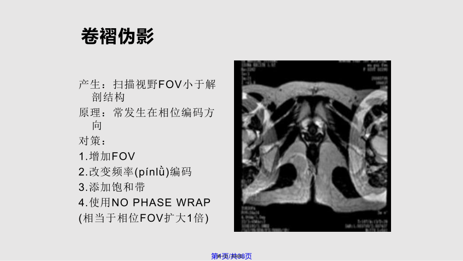 常见MR伪影及对策实用教案_第1页