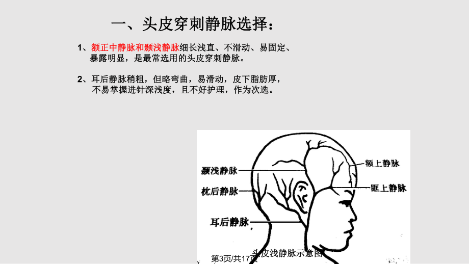 儿科头皮静脉穿刺技术及相关知识ppt课件