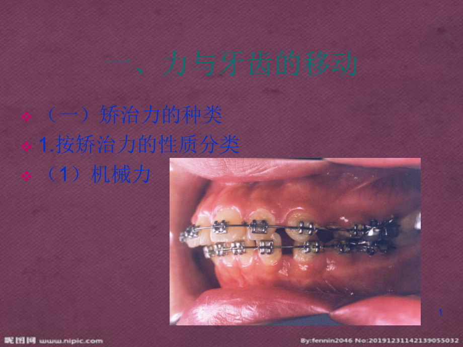 口腔正畸學(xué) 正畸治療的生物機(jī)械原理PPT_第1頁