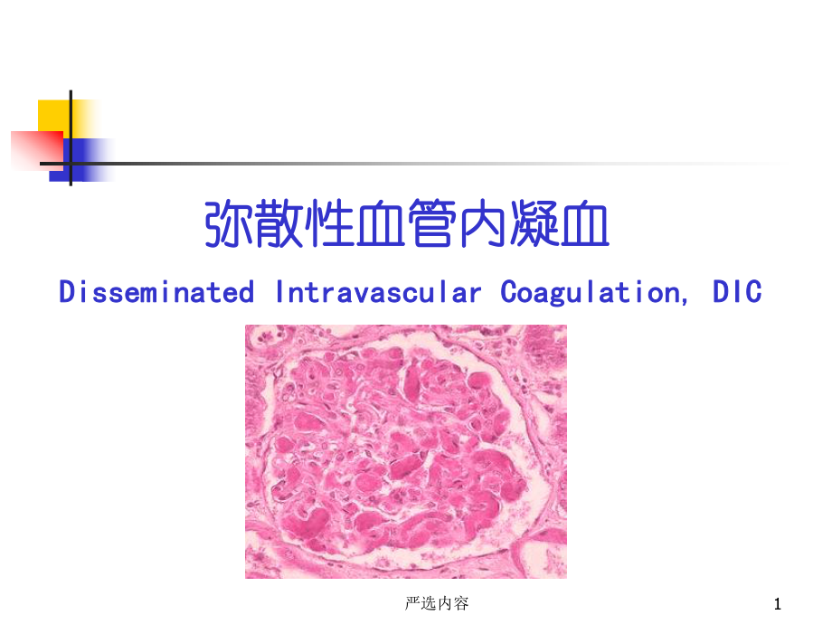 DIC的诊断及治疗弥散性血管内凝血优选内容_第1页