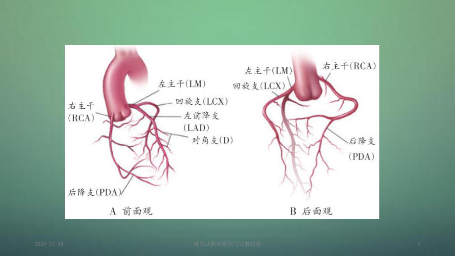 冠狀動脈的解剖與冠脈造影_第3頁