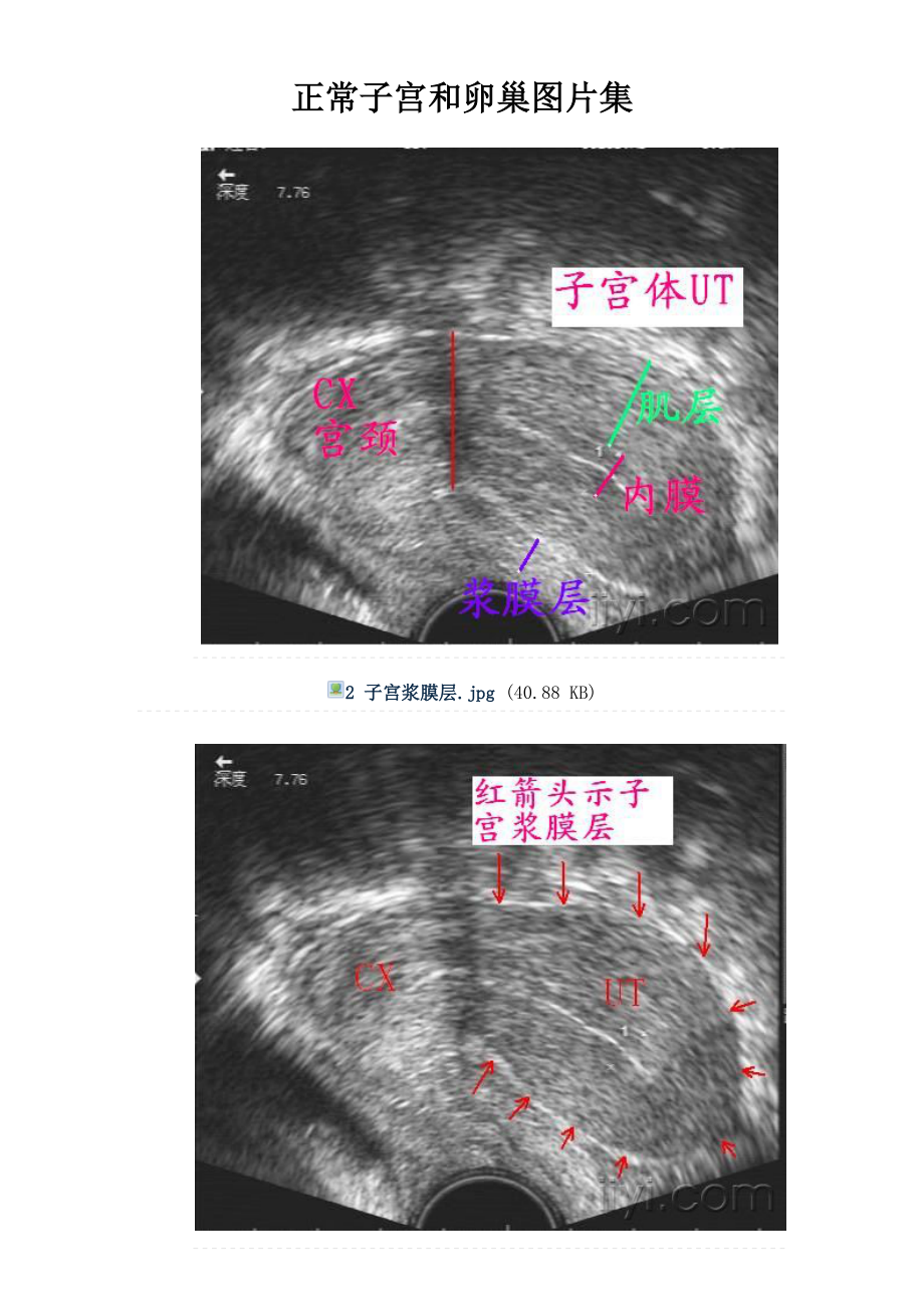 正常子宫和卵巢图片集_第1页