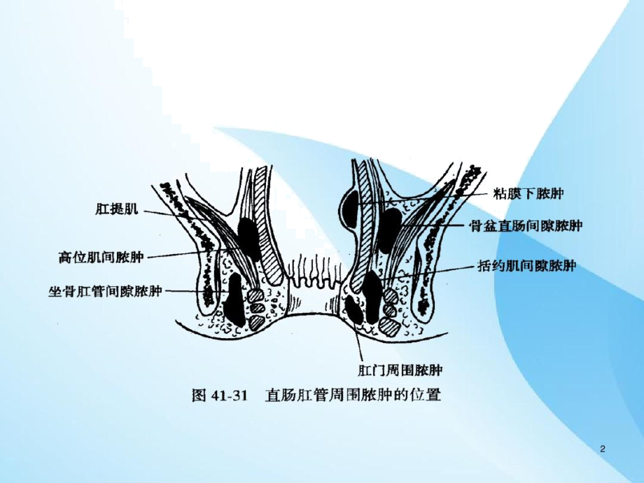 肛管位置图图片