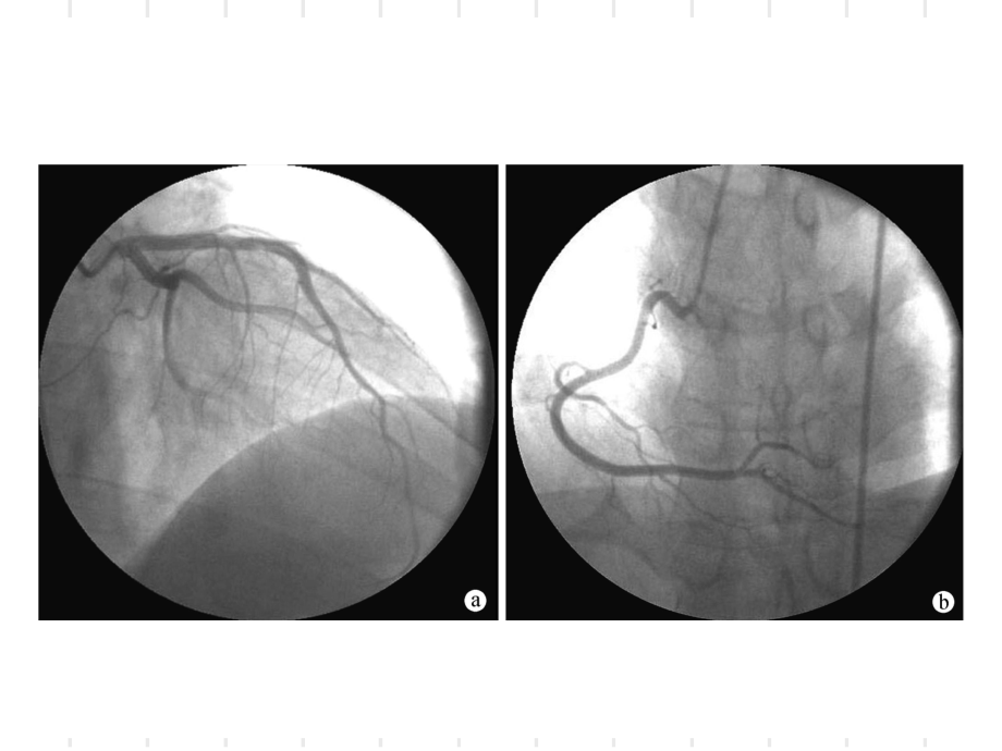 stemi305图片