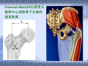 最新：[PPT]正常髋关节股骨偏心距的影像学研究文档资料