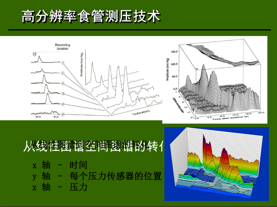 高分辨率食管测压检测技术临床应用文档资料_第1页