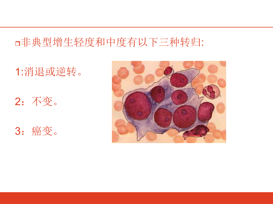 宫颈腺体鳞化什么意思文档资料