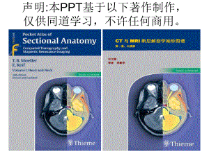 头颈CTMRI解剖图解系列6
