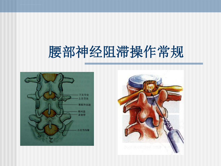 腰部神经阻滞操作常规ppt课件_第1页