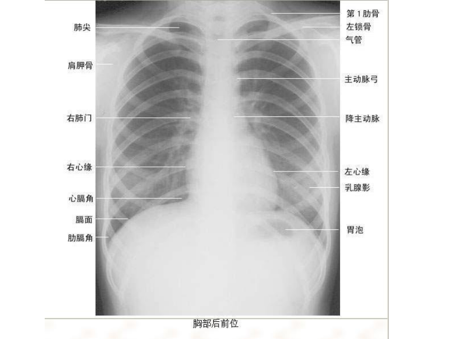 正常x线读课件