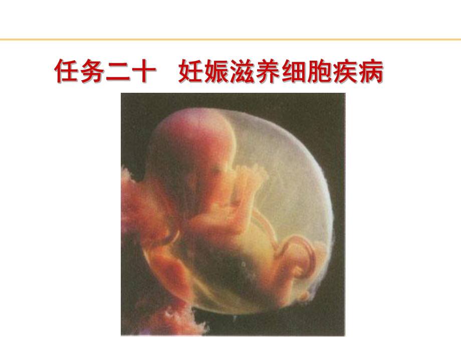 妊娠滋养细胞疾病ppt课件_第1页