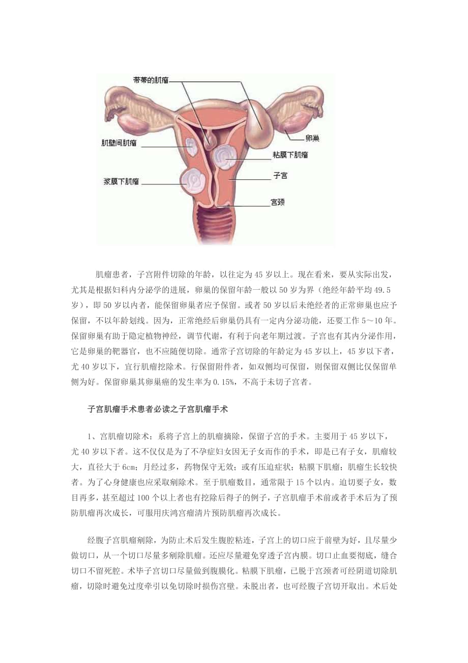子宫肌瘤手术患者必读_第1页