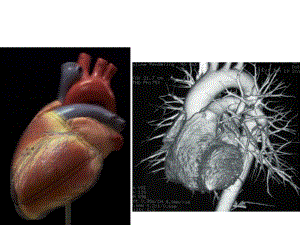 心脏病影像诊断基础2