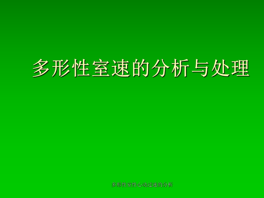 多形性室性心动过速的分析课件_第1页