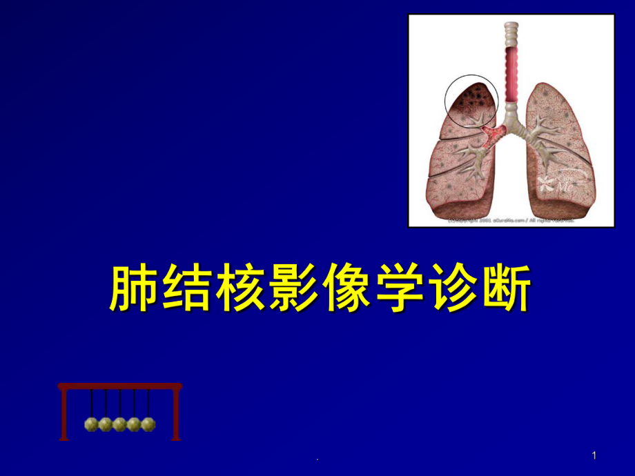 肺结核影像学诊断课堂PPT_第1页