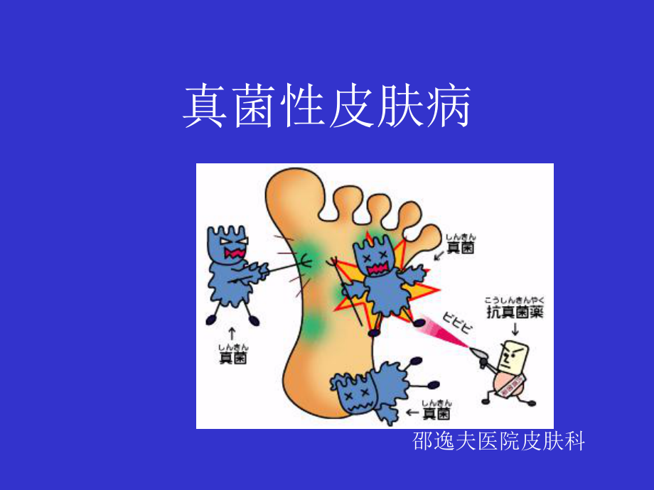 《真菌性感染》PPT课件_第1页