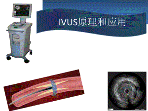 血管内超声IVUS原理和应用PPT课件
