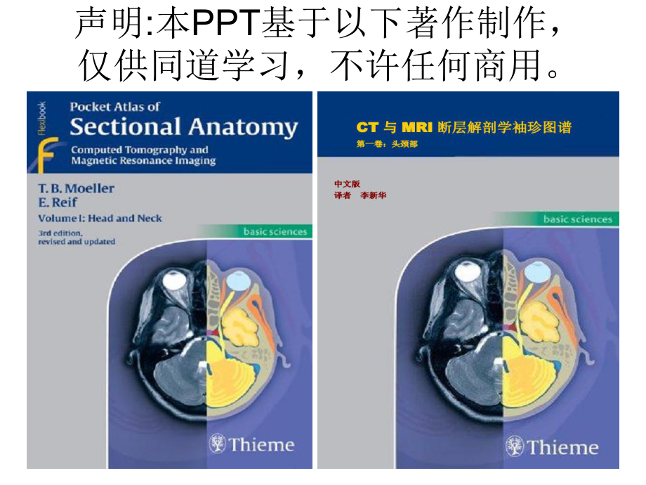 头颈CTMRI解剖图解系列4_第1页