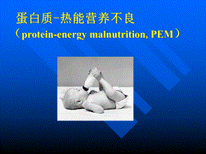 第七章-第一节蛋白质热能营养不良课件