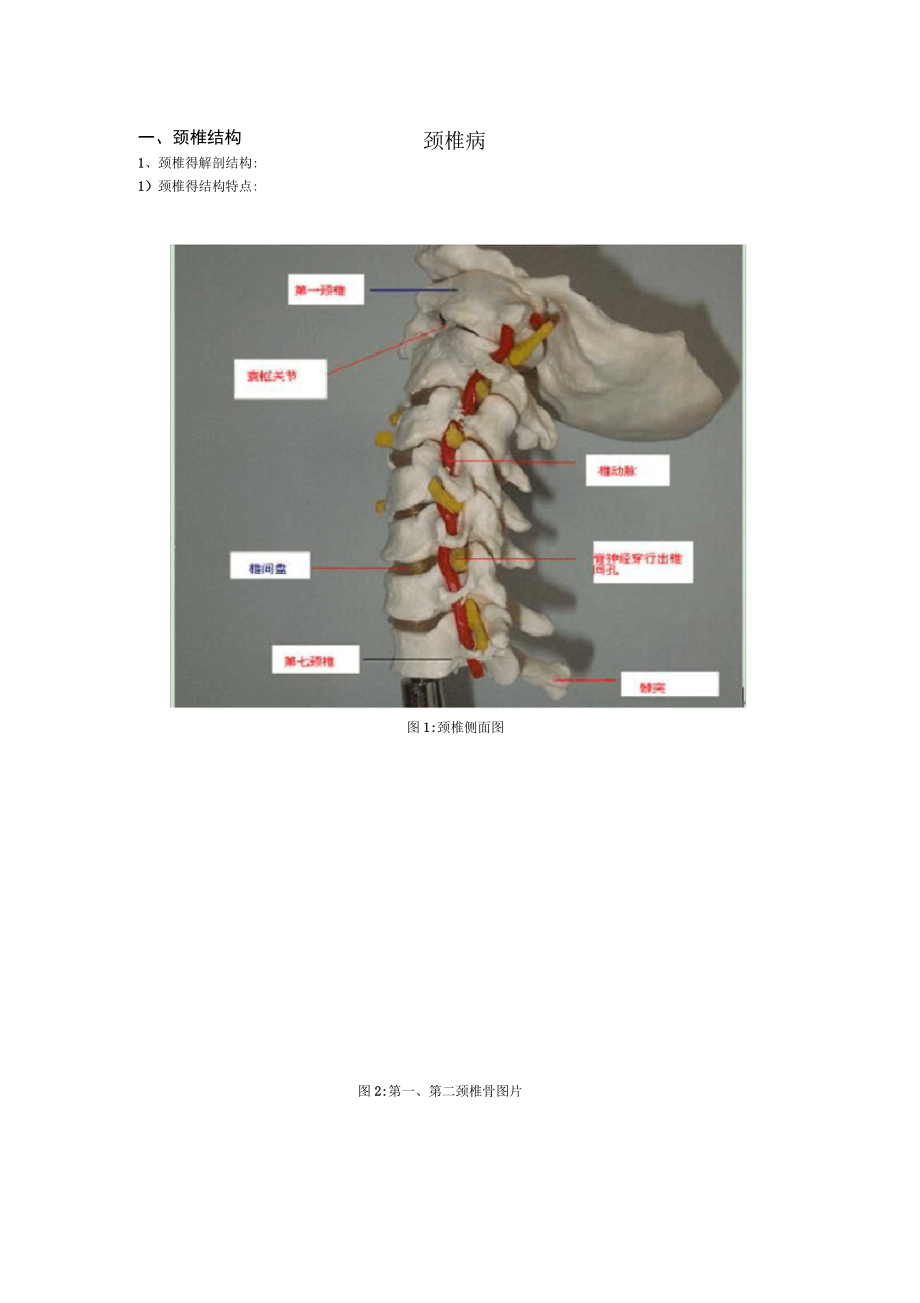 頸椎病內(nèi)容整理_第1頁
