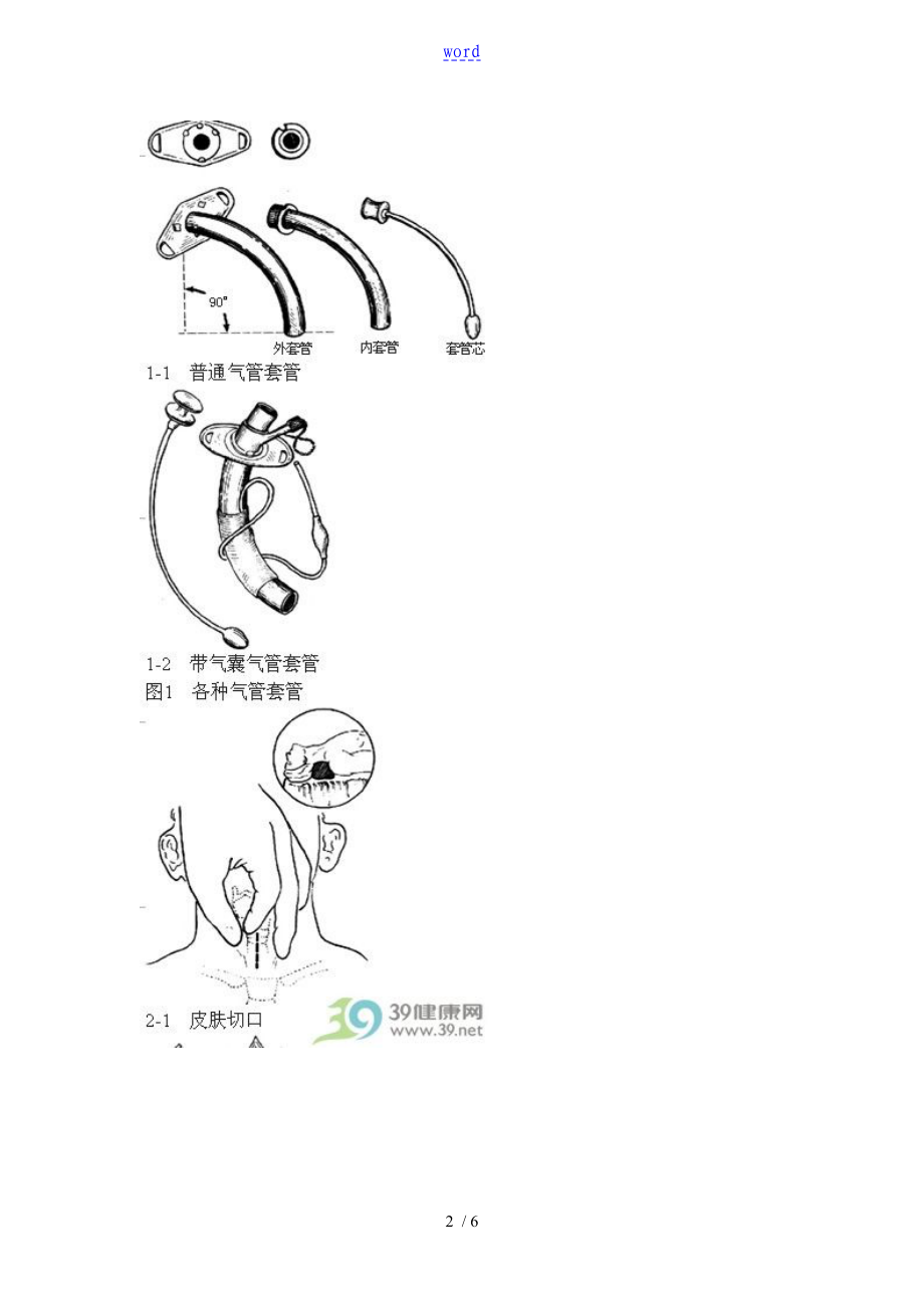 气管切开术步骤图解图片