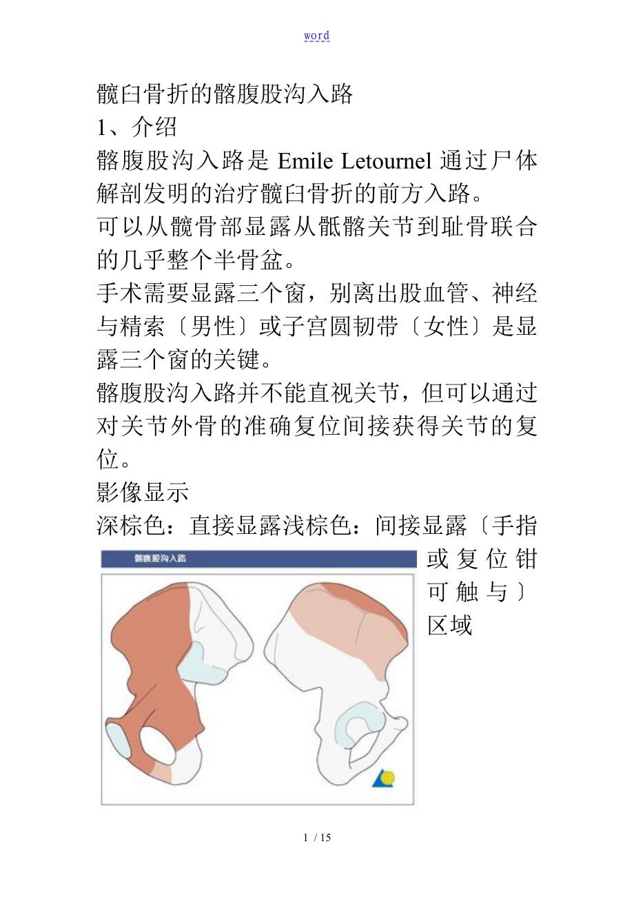 髂腹股沟入路解剖_第1页