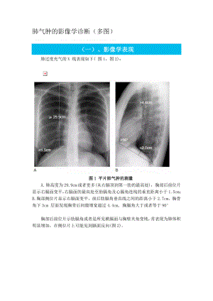肺气肿的影像学诊断