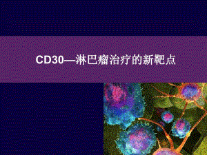 CD30淋巴瘤治疗新靶点